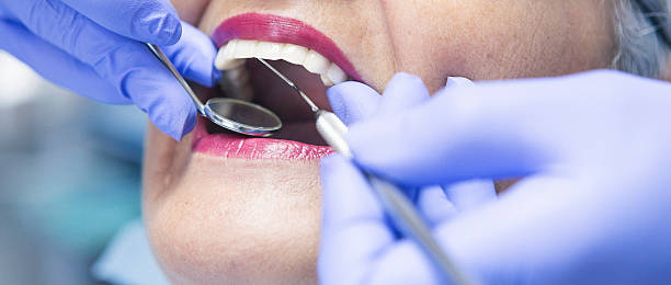 Best Urgent Care for Lost Fillings or Crowns in El Segundo, CA